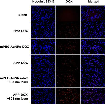 Upper-Critical-Solution-Temperature Polymer Modified Gold Nanorods for Laser Controlled Drug Release and Enhanced Anti-Tumour Therapy